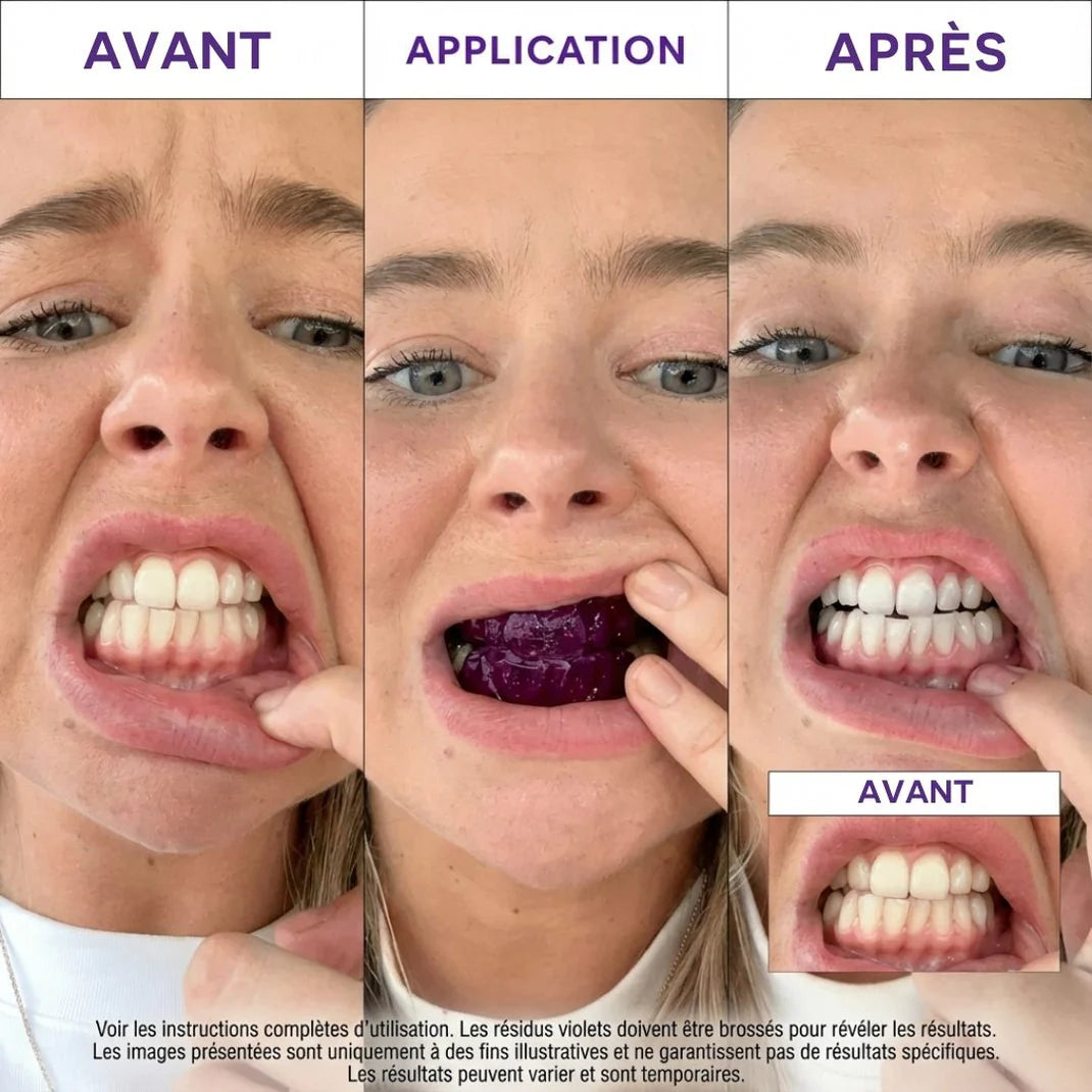 SmileGlow SOIELYSSE Violeta™