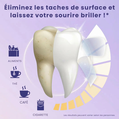 SmileGlow SOIELYSSE Violeta™