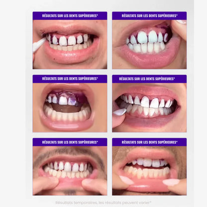 SmileGlow SOIELYSSE Violeta™